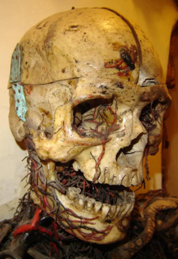 The skull of one of the Anatomical Machines, laced with reconstructed blood vessels